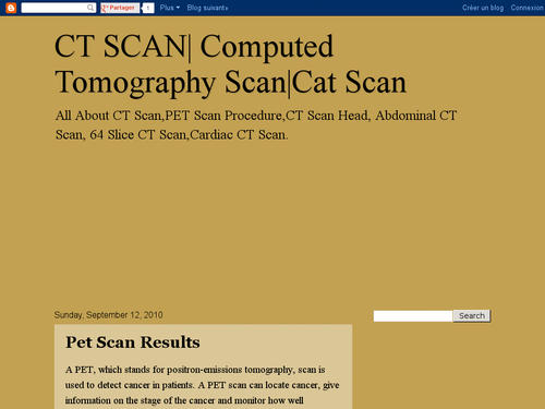 CT Scan|Cat Scan